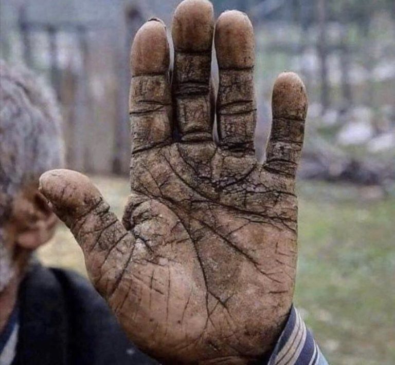 اليد المتسخة في المنام